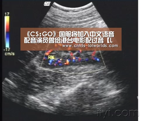 英雄联盟世界赛